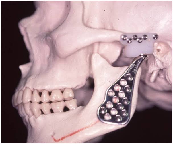 Dores na articulação mandibular diminuem com uso de laser – AUN