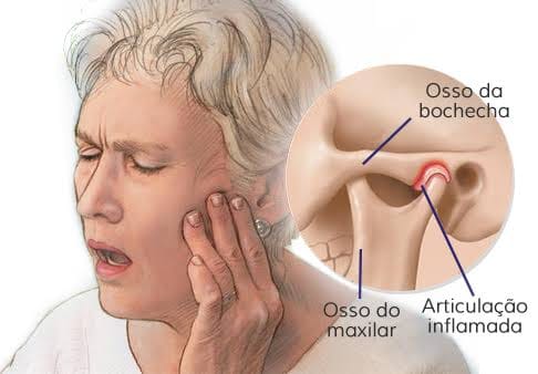 Dores Orofaciais e Desordens da ATM